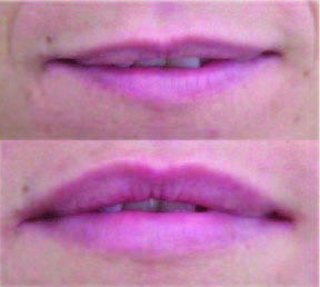 Lips 1